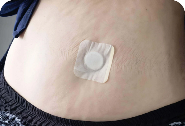 Rejuvacare OzemPatch™ – Original Revolutionary Transdermal Patch - Image 3